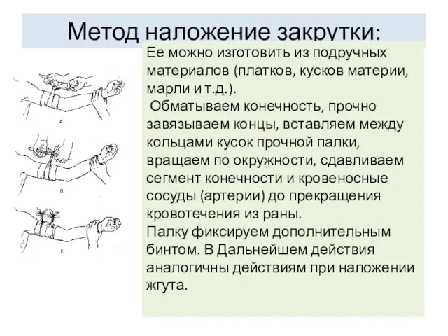 Метод наложение закрутки: Ее можно изготовить из подручных материалов (платков, кусков