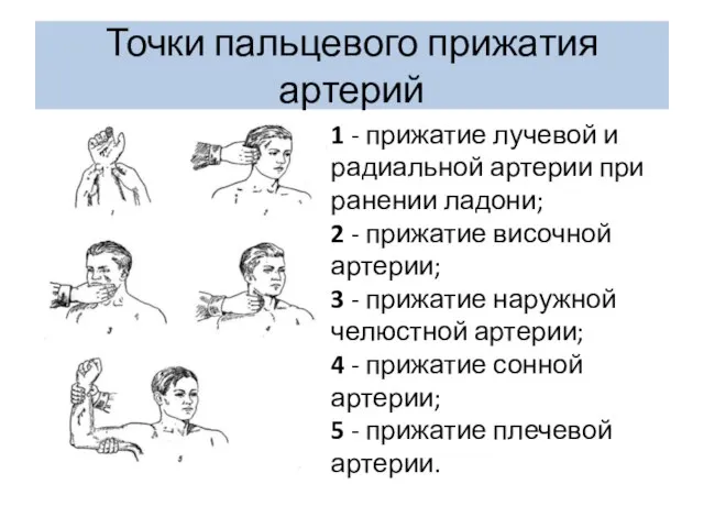 Точки пальцевого прижатия артерий 1 - прижатие лучевой и радиальной артерии