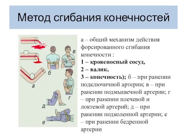 Метод сгибания конечностей а – общий механизм действия форсированного сгибания конечности