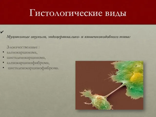 Гистологические виды Муцинозные опухоли, эндоцервикально- и кишечноподобного типа: Злокачественные : аденокарцинома, цистаденокарцинома, аденокарцинофиброма, цистаденокарцинофиброма.