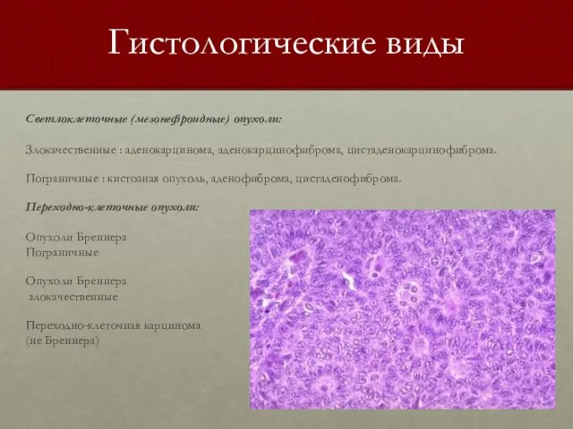 Гистологические виды Светлоклеточные (мезонефроидные) опухоли: Злокачественные : аденокарцинома, аденокарцинофиброма, цистаденокарцинофиброма. Пограничные