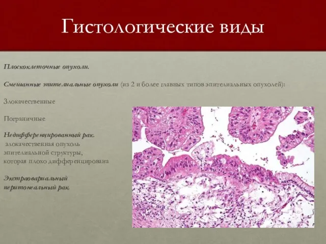 Гистологические виды Плоскоклеточные опухоли. Смешанные эпителиальные опухоли (из 2 и более