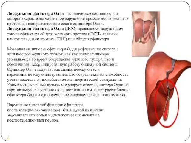 Дисфункция сфинктера Одди – клиническое состояние, для которого характерно частичное нарушение