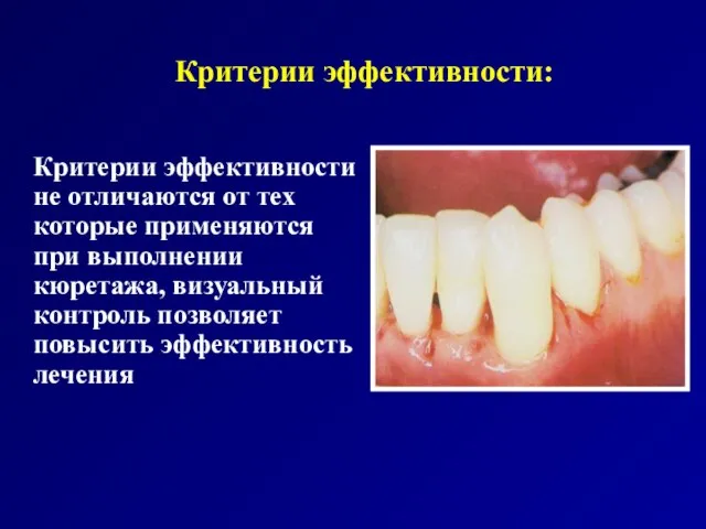 Критерии эффективности: Критерии эффективности не отличаются от тех которые применяются при