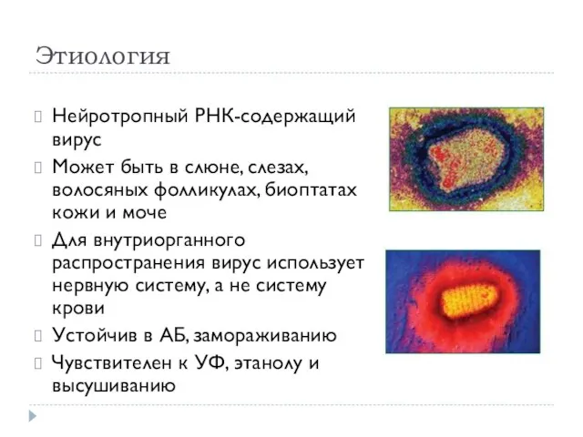 Этиология Нейротропный РНК-содержащий вирус Может быть в слюне, слезах, волосяных фолликулах,