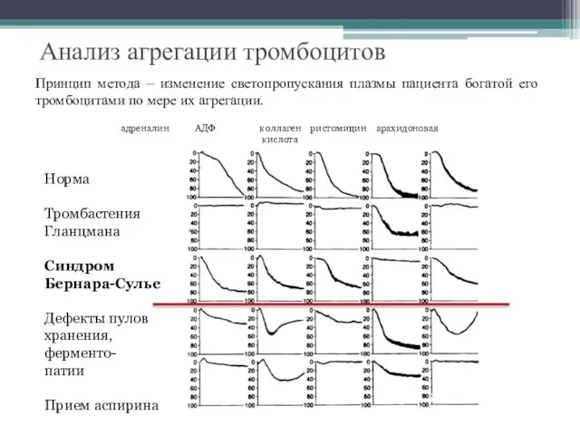 адреналин АДФ коллаген ристомицин арахидоновая кислота Норма Тромбастения Гланцмана Синдром Бернара-Сулье