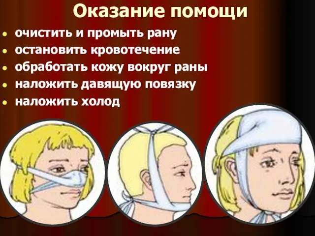 Оказание помощи очистить и промыть рану остановить кровотечение обработать кожу вокруг