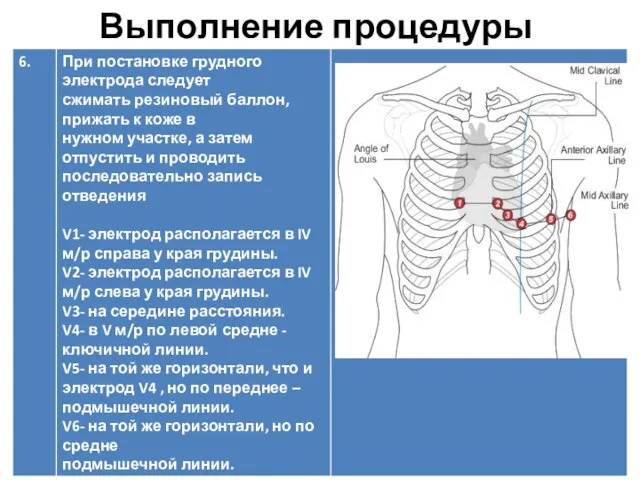 Выполнение процедуры