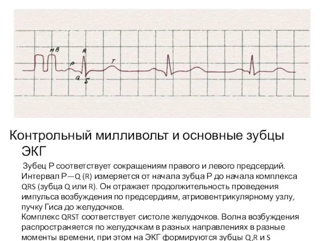 Контрольный милливольт и основные зубцы ЭКГ Зубец Р соответствует сокращениям правого