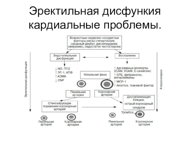 Эректильная дисфункия кардиальные проблемы.