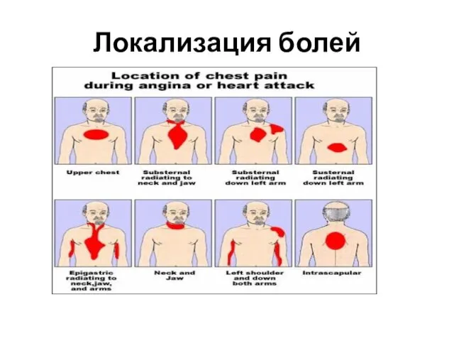 Локализация болей