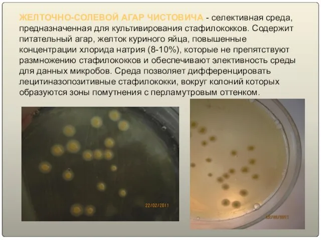 ЖЕЛТОЧНО-СОЛЕВОЙ АГАР ЧИСТОВИЧА - селективная среда, предназначенная для культивирования стафилококков. Содержит