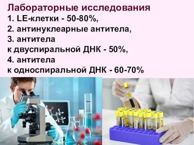 Лабораторные исследования 1. LE-клетки - 50-80%, 2. антинуклеарные антитела, 3. антитела