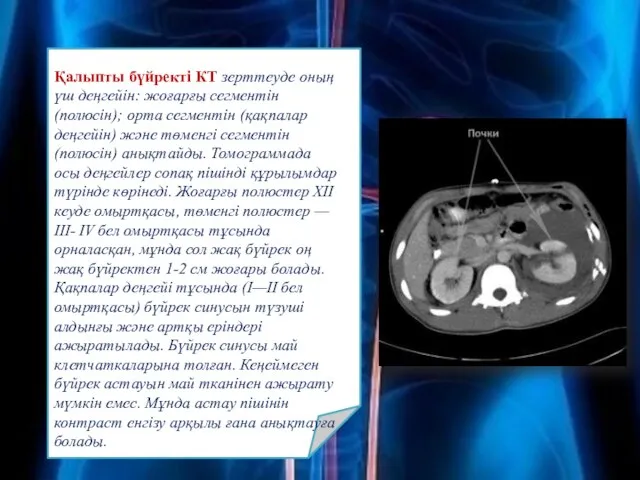 Қалыпты бүйректі КТ зерттеуде оның үш деңгейін: жоғарғы сегментін (полюсін); орта