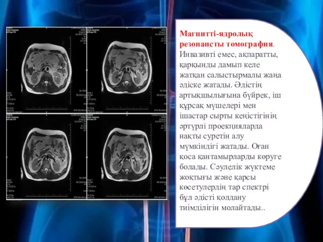 Магнитті-ядролық резонансты томография. Инвазивті емес, ақпаратты, қарқынды дамып келе жатқан салыстырмалы