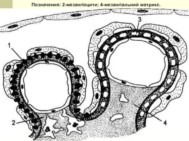 Позначення: 2-мезангіоцити; 4-мезангіальний матрикс.