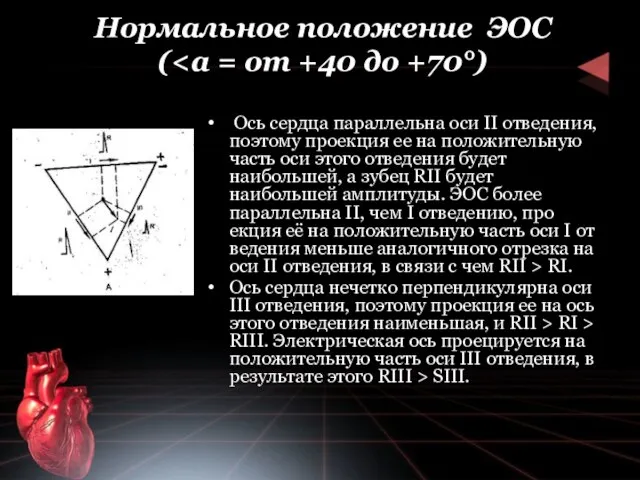 Нормальное положение ЭОС ( Ось сердца параллельна оси II отведения, поэтому