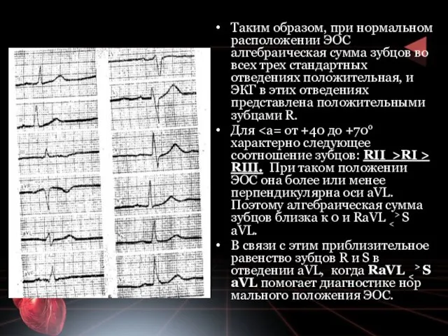 Таким образом, при нормальном расположении ЭОС алгебраическая сумма зубцов во всех