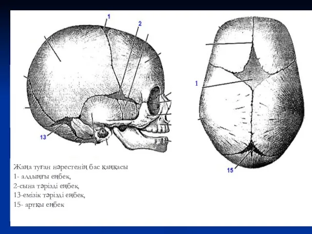 Жаңа туған нәрестенің бас қаңқасы 1- алдыңғы еңбек, 2-сына тәрізді еңбек,