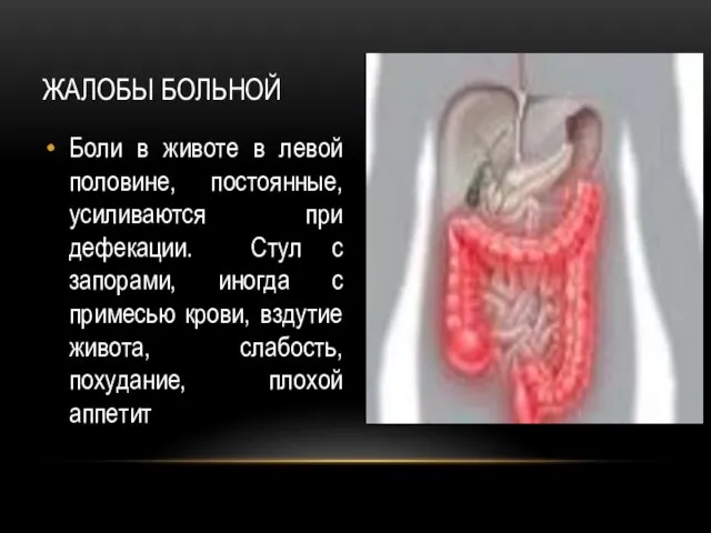 Боли в животе в левой половине, постоянные, усиливаются при дефекации. Стул