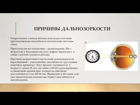 ПРИЧИНЫ ДАЛЬНОЗОРКОСТИ Укороченное глазное яблоко или недостаточная преломляющая способность оптической системы