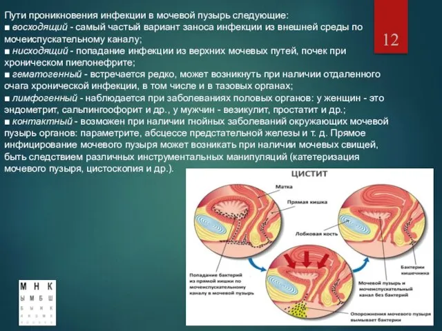 Пути проникновения инфекции в мочевой пузырь следующие: ■ восходящий - самый