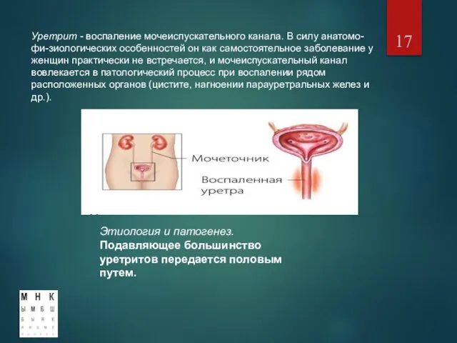 Уретрит - воспаление мочеиспускательного канала. В силу анатомо-фи-зиологических особенностей он как