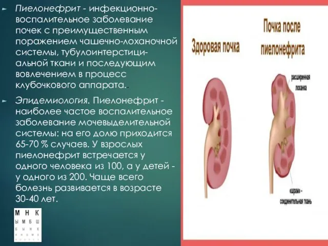 Пиелонефрит - инфекционно-воспалительное заболевание почек с преимущественным поражением чашечно-лоханочной системы, тубулоинтерстици-альной