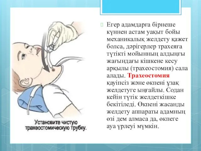 Егер адамдарға бірнеше күннен астам уақыт бойы механикалық желдету қажет болса,