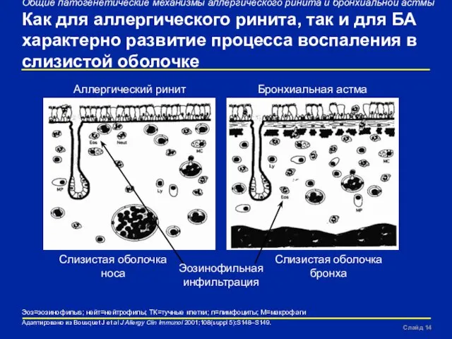 Slide Общие патогенетические механизмы аллергического ринита и бронхиальной астмы Как для