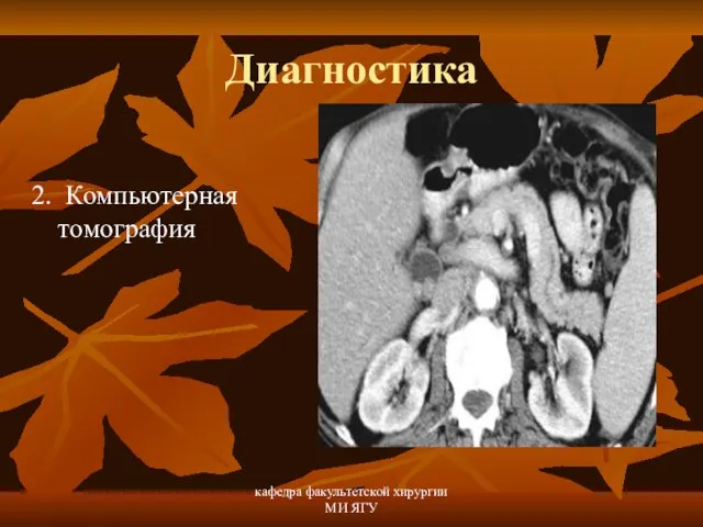 кафедра факультетской хирургии МИ ЯГУ Диагностика 2. Компьютерная томография