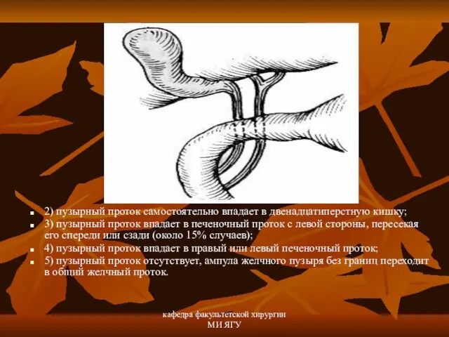 кафедра факультетской хирургии МИ ЯГУ 2) пузырный проток самостоятельно впадает в