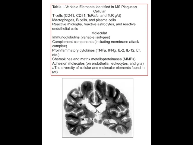 Table I. Variable Elements Identified in MS Plaquesa Cellular T cells