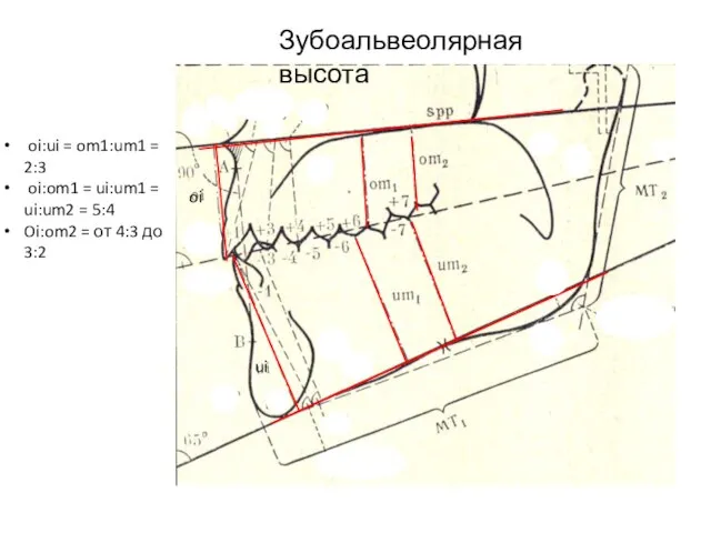 Зубоальвеолярная высота oi ui oi:ui = om1:um1 = 2:3 oi:om1 =