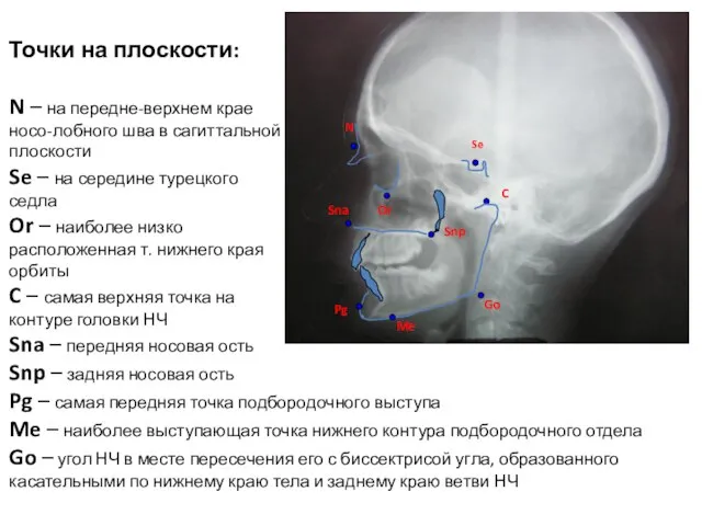 Se N Or C Sna Snp Pg Me Go Точки на