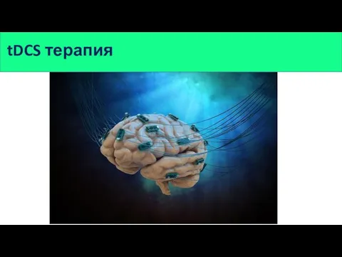 tDCS терапия