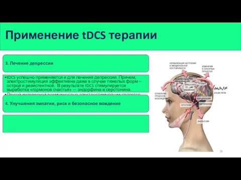 Применение tDCS терапии 3. Лечение депрессии tDCS успешно применяется и для