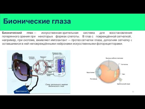 Бионический глаз — искусственная зрительная система для восстановления потерянного зрения при