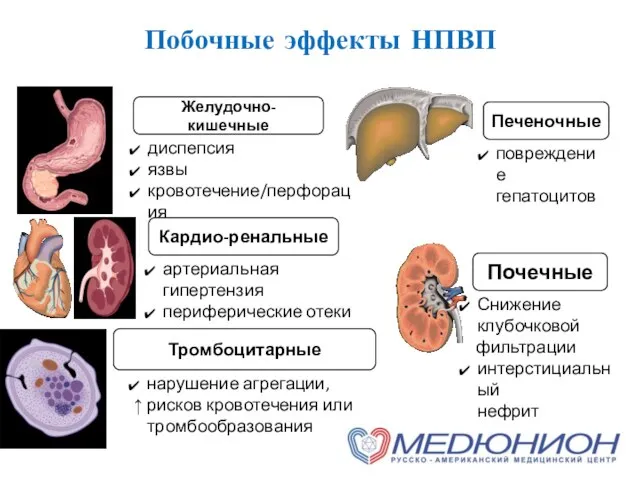 Побочные эффекты НПВП