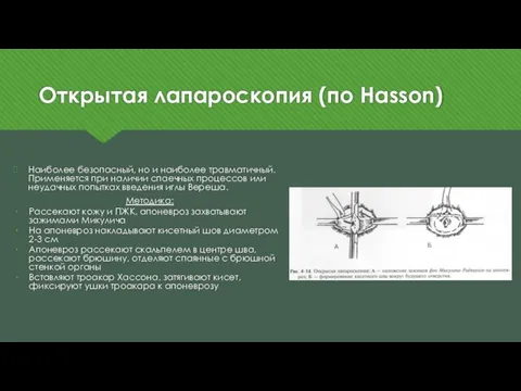 Открытая лапароскопия (по Hasson) Наиболее безопасный, но и наиболее травматичный. Применяется