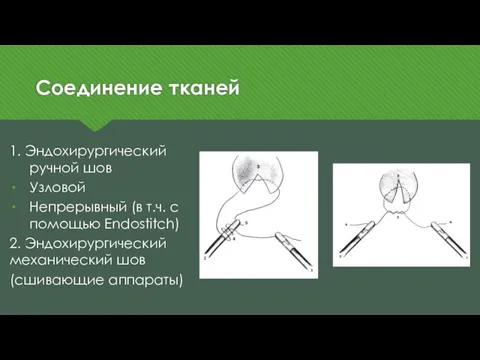 Соединение тканей 1. Эндохирургический ручной шов Узловой Непрерывный (в т.ч. с