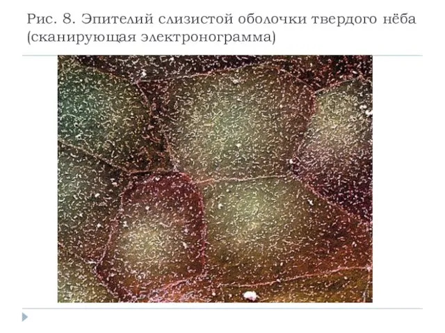 Рис. 8. Эпителий слизистой оболочки твердого нёба (сканирующая электронограмма)