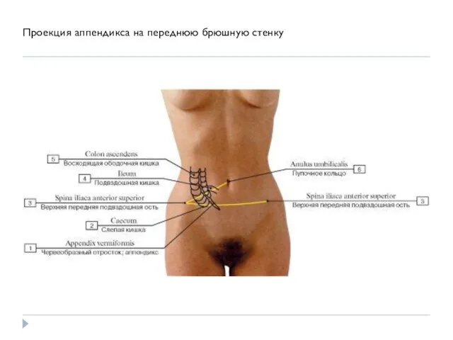 Проекция аппендикса на переднюю брюшную стенку