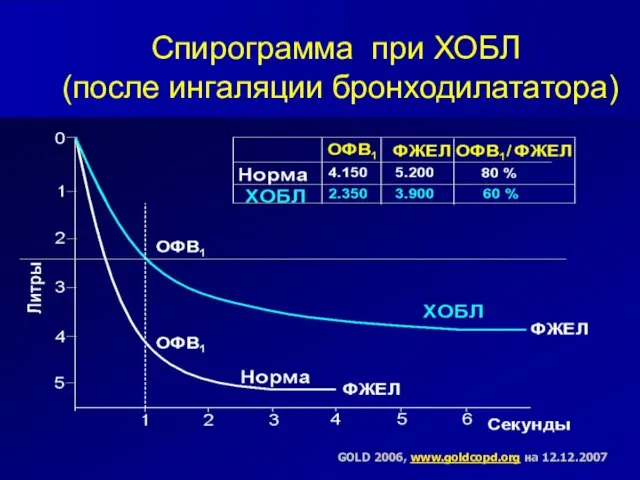 Спирограмма при ХОБЛ (после ингаляции бронходилататора) GOLD 2006, www.goldcopd.org на 12.12.2007