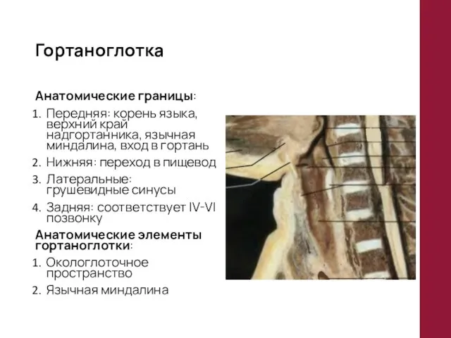 Гортаноглотка Анатомические границы: Передняя: корень языка, верхний край надгортанника, язычная миндалина,