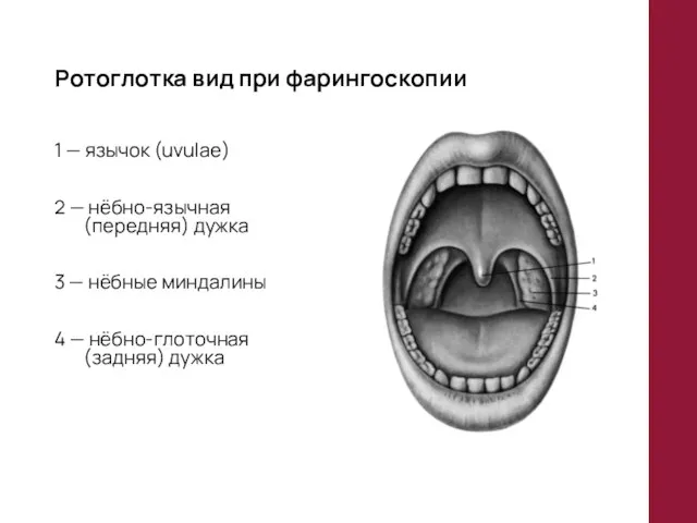 Ротоглотка вид при фарингоскопии 1 — язычок (uvulae) 2 — нёбно-язычная