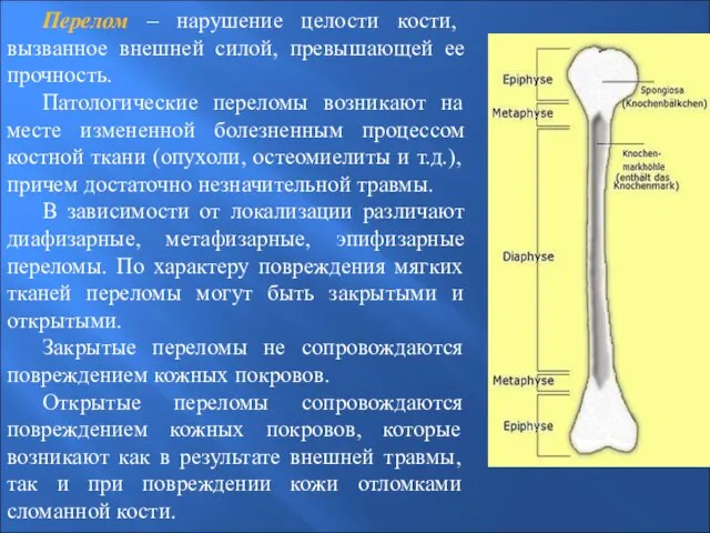 Перелом – нарушение целости кости, вызванное внешней силой, превышающей ее прочность.