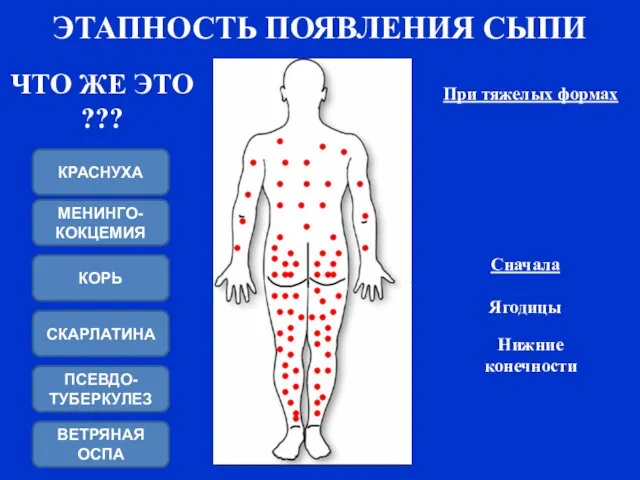 ЭТАПНОСТЬ ПОЯВЛЕНИЯ СЫПИ Ягодицы Нижние конечности Сначала При тяжелых формах ЧТО