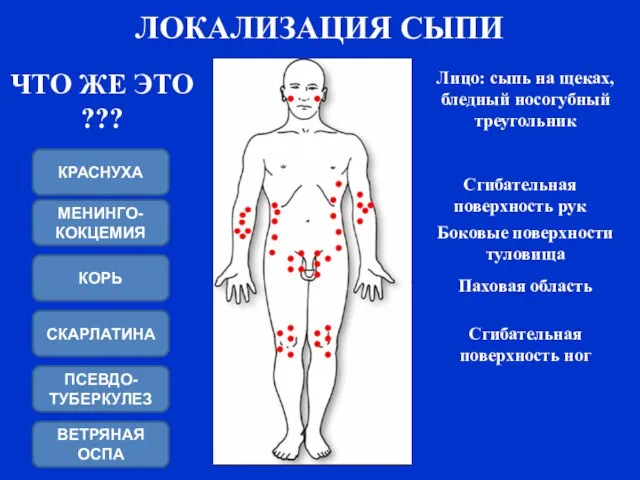 СКАРЛАТИНА ПСЕВДО-ТУБЕРКУЛЕЗ КОРЬ ЛОКАЛИЗАЦИЯ СЫПИ Сгибательная поверхность рук Сгибательная поверхность ног