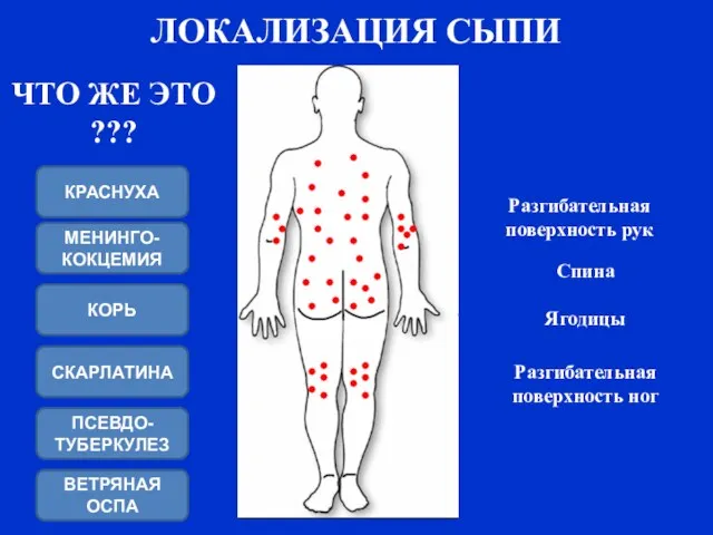 Разгибательная поверхность рук Разгибательная поверхность ног Спина Ягодицы ЛОКАЛИЗАЦИЯ СЫПИ ЧТО